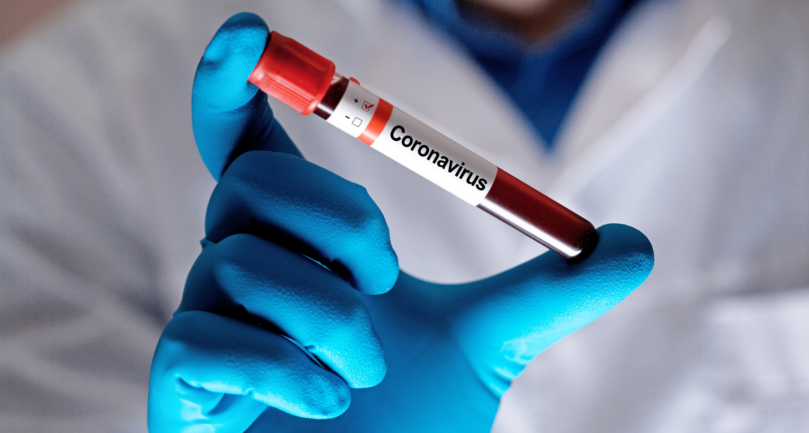 Corona virus Epidemic